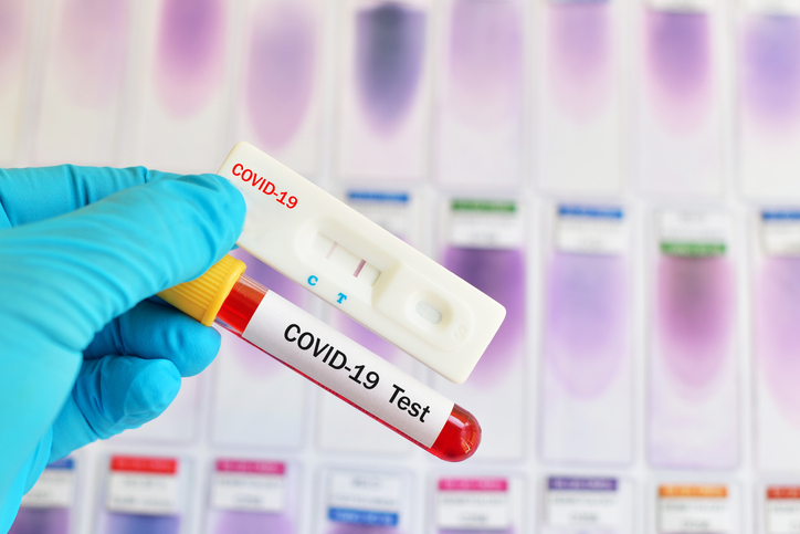Best COVID-19 Diagnostic Tests Global WholeHealth Partners 877-568-4947
