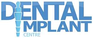 Dental Implants Mt Pleasant, Charleston SC | Affordable Dentures