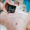 Balm-X has a variety of uses, as demonstrated here after body contouring - CBD Unlimited