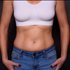 Promote Weight Loss With Exercise And Twist 25 DHEA Cream