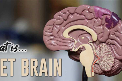 What is Wet Brain? Symptoms, Treatment and Recovery